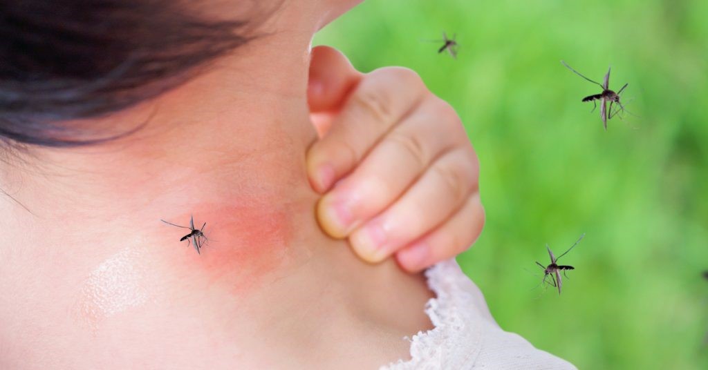 How Can I Prevent and Treat Mosquito Bites? | FastMed Urgent Care