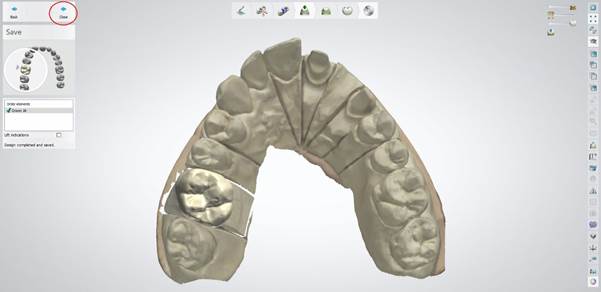 A close-up of a model of teeth

Description automatically generated