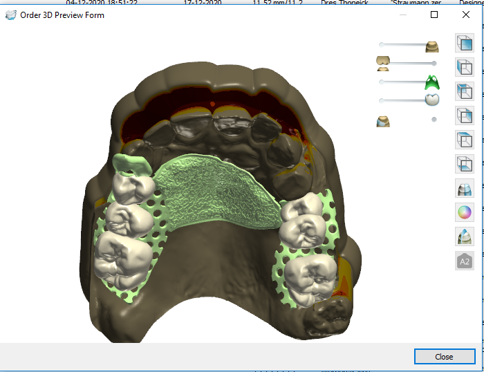 A computer screen shot of a model of teeth

Description automatically generated