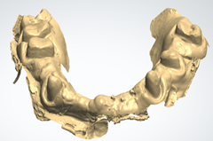 A close-up of a bone

Description automatically generated