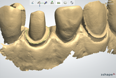 A close-up of a model of teeth

Description automatically generated