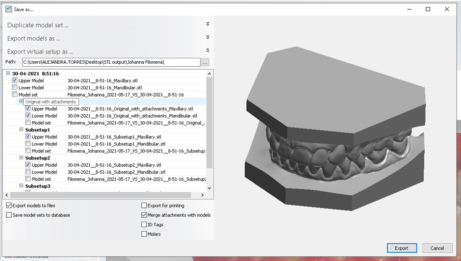 Not able to export as STL the Virtual setup with attachments in Ortho  Analyzer - 3Shape