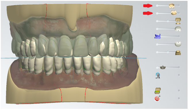 A close-up of a model of teeth

Description automatically generated