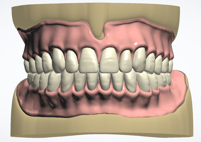 A model of a human teeth

Description automatically generated