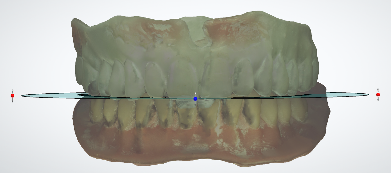 A close-up of a model of teeth

Description automatically generated